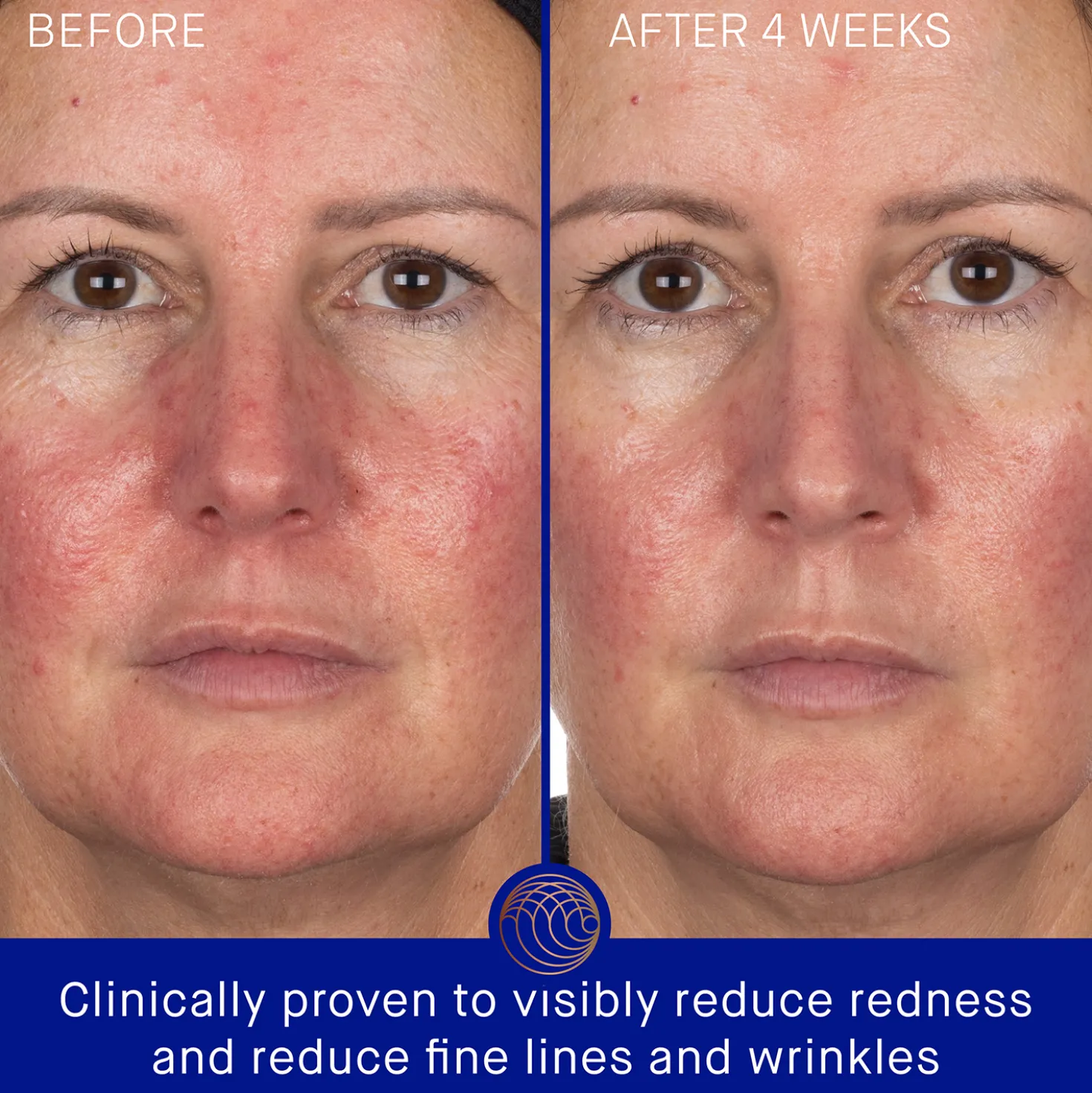 The Hydrogel Face Mask 6 Pack