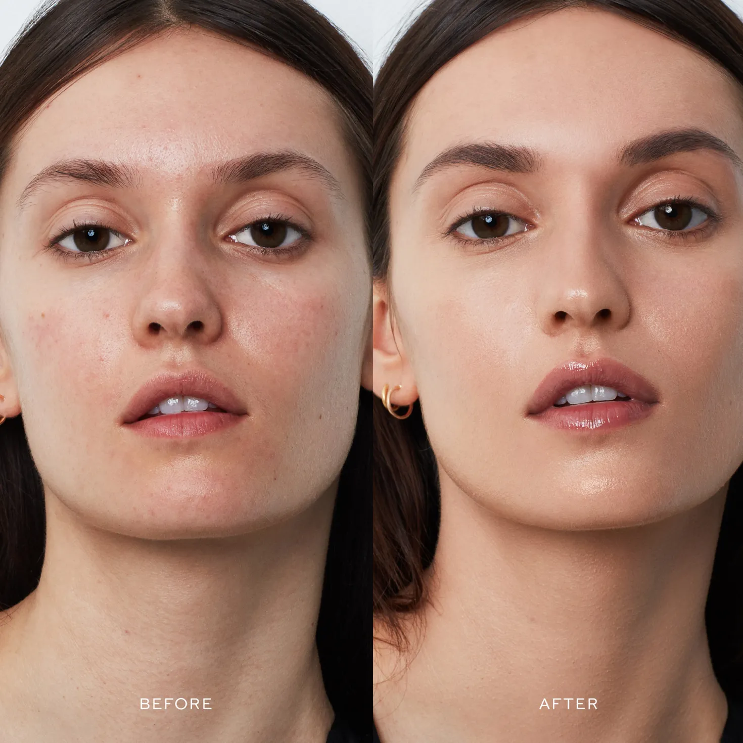 Vital Skincare Complexion Drops III